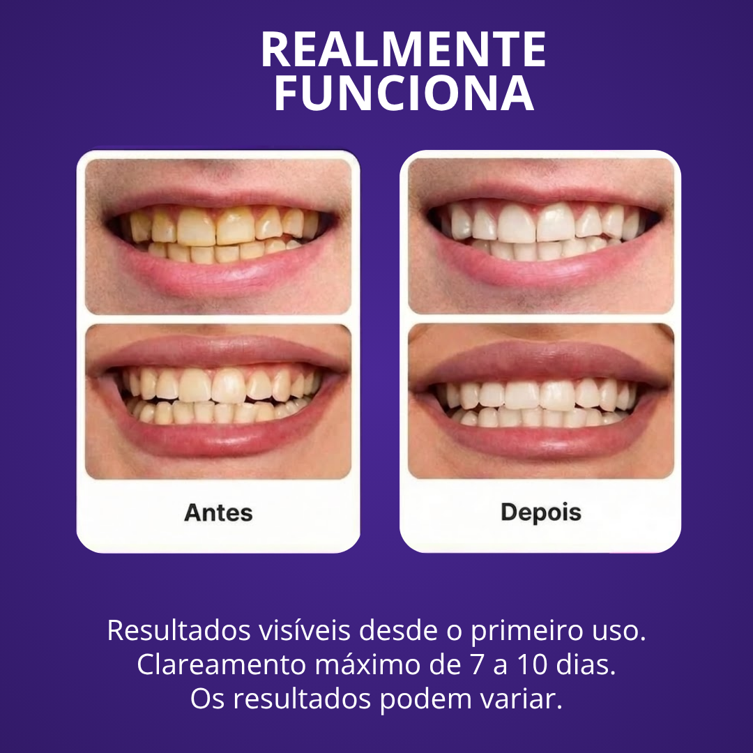 Lumident - Tiras Clareadoras Roxas com Efeito Corretor de Cor